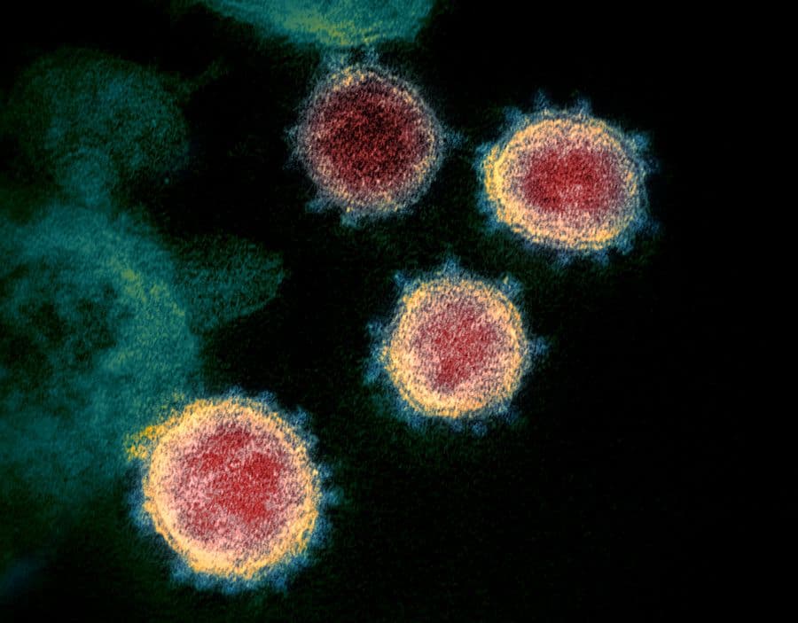 The COVID-19 Pandemic and Geopolitics